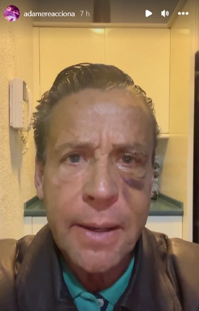 Así dio a conocer Alfredo Adame la noticia que sería operado