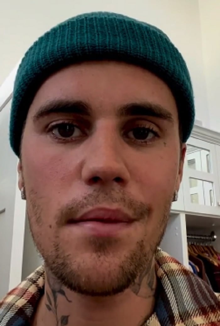 Justin Bieber revela que este padecimiento "es bastante grave"