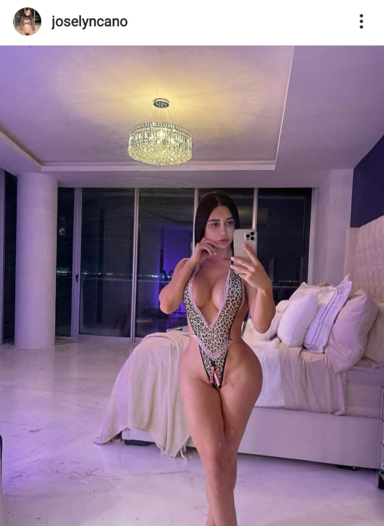 They assure that the model Joselyn Cano died of complications from a buttock plastic surgery