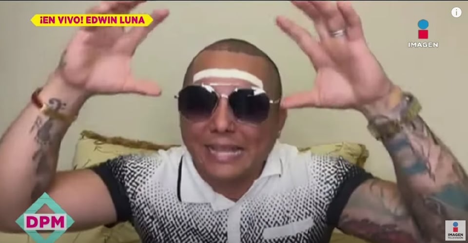 Edwin Luna estuvo a punto de perder un brazo