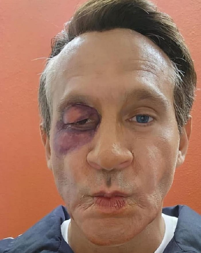 Se burlan de la golpiza que recibió