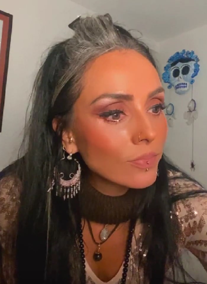 "Me quemé ambas córneas"