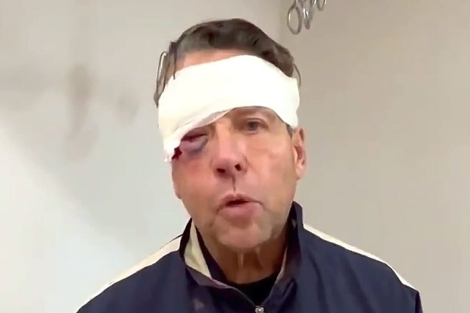 Operan de emergencia a Alfredo Adame tras golpiza que recibió