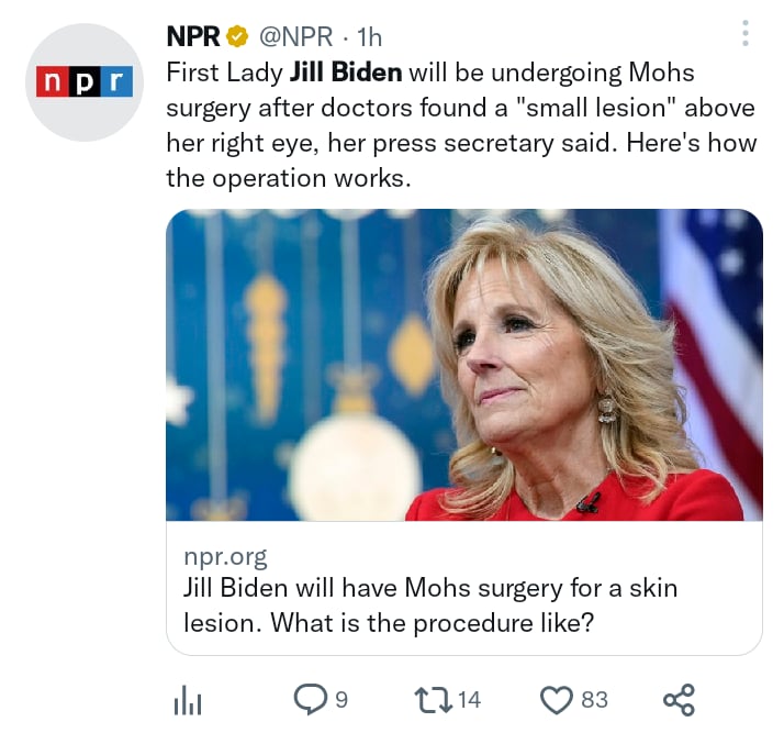 Jill Biden sometida cirugía