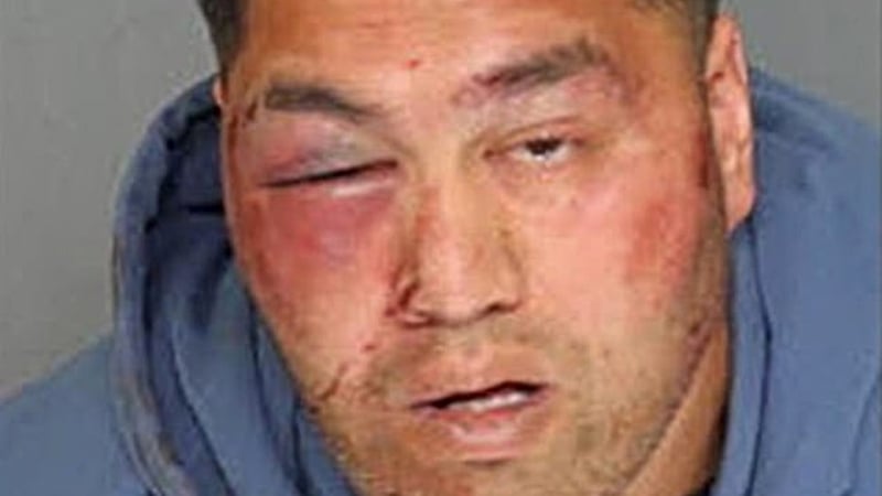 Crónica: Reventaron la cara a escalofriante asesino por resistirse al arresto