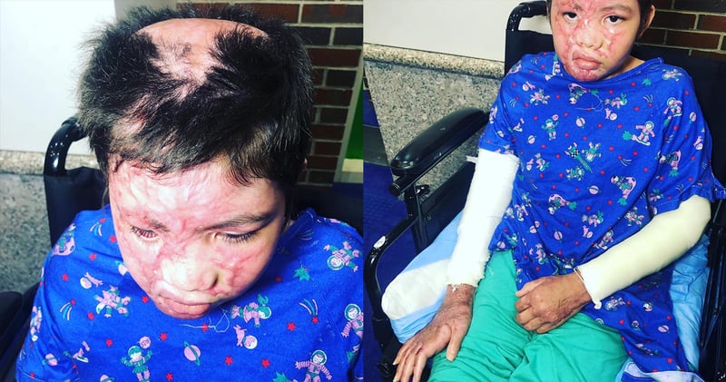 Crónica: El destino le arrebató a sus seres amados y lo dejó bien quemado