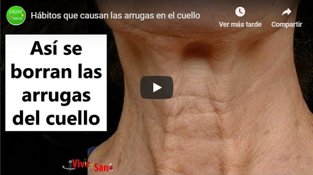 Arrugas en el cuello: Hábitos que puedes evitar y hacer que aparezcan