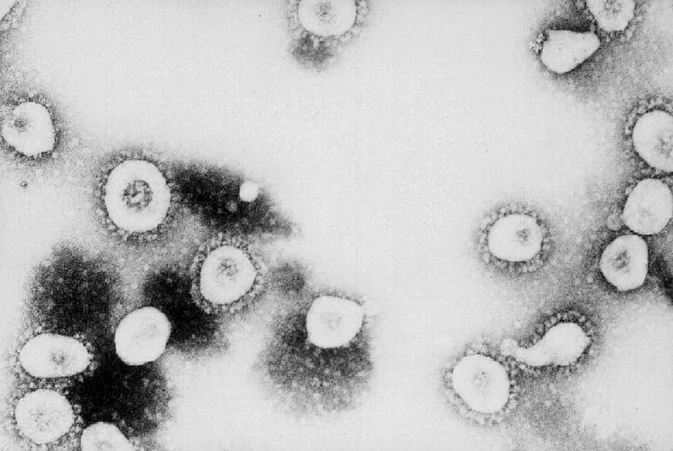 Vacuna contra coronavirus podría no aparecer: OMS