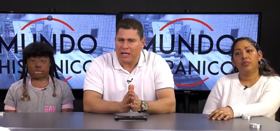 Niña con fuertes quemaduras le envía un mensaje a la comunidad hispana en los Estados Unidos featured image