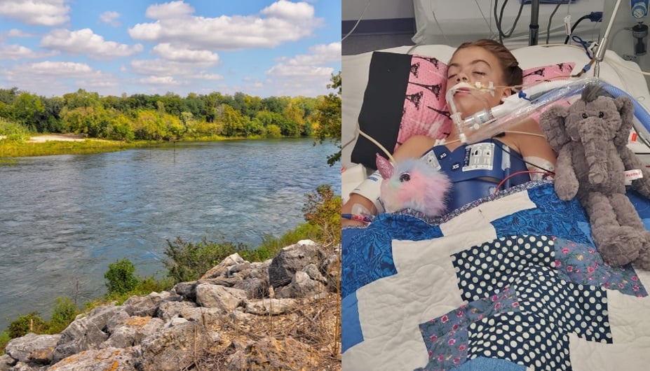Niña lucha por su vida después de contraer una ameba comecerebro