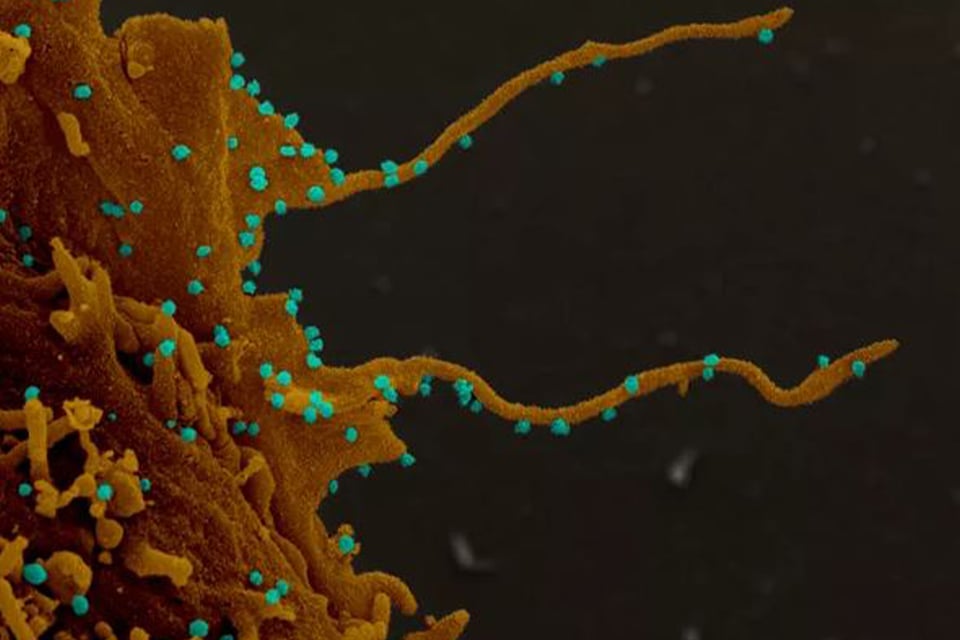 Revelan que el coronavirus hace que en las células crezcan «tentáculos»