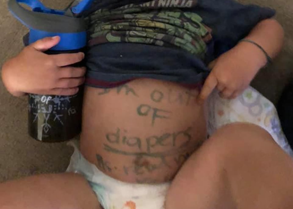 Despiden a cuidadora en Florida por escribir mensaje en la barriga de un bebé