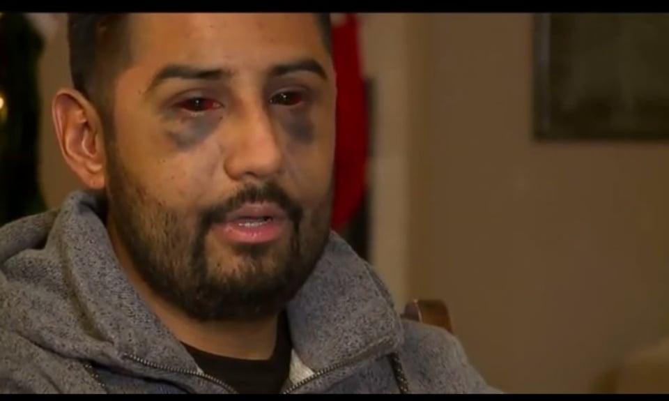 Hispano golpeado brutalmente por oficiales los acusa de racistas en Instagram (FOTOS Y VIDEO) featured image