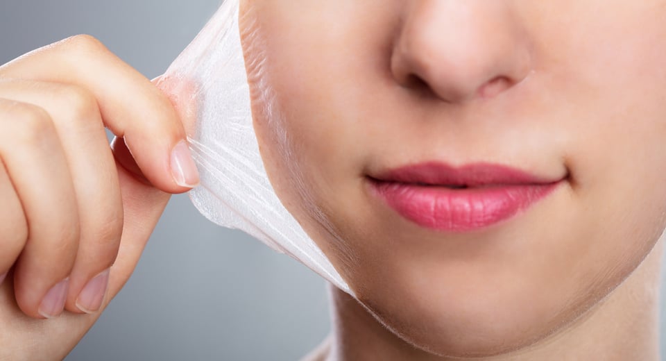 Peeling natural y casero para piel quemada por el sol, prueba estas 3 recetas caseras