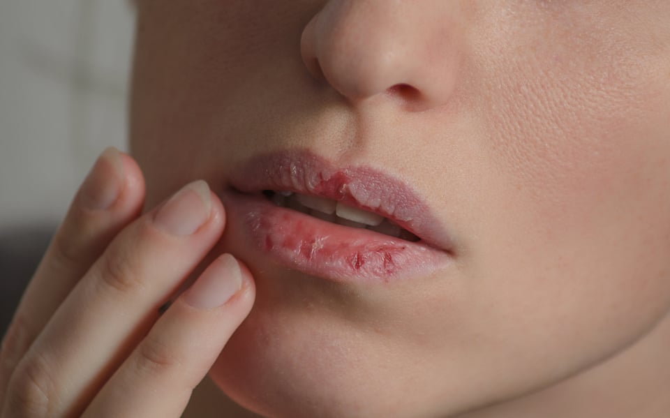 Consejos para lidiar con los labios resecos (VIDEO)