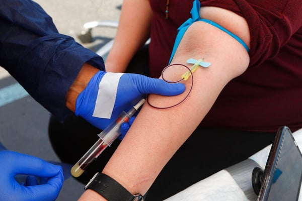 Estudio de anticuerpos ofrece esperanza hacia vacunación