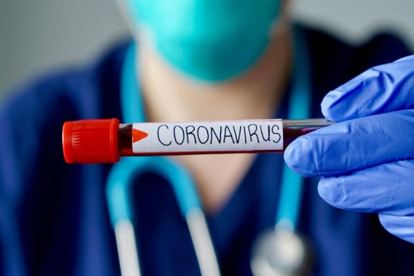 Coronavirus: Revelan que aceite coco destruye el virus del Covid-19 (FOTO)