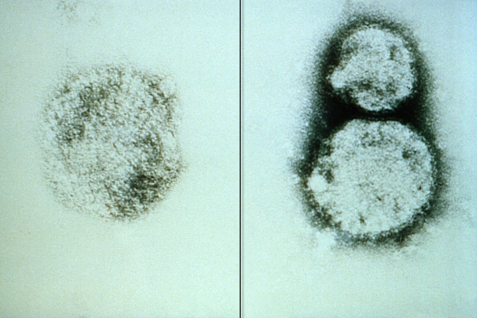 En medio de crisis por coronavirus reportan un muerto por hantavirus en China y se prenden las alertas featured image