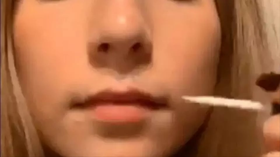 Nueva y peligrosa tendencia de belleza, pegarse el labio a la piel bajo la nariz