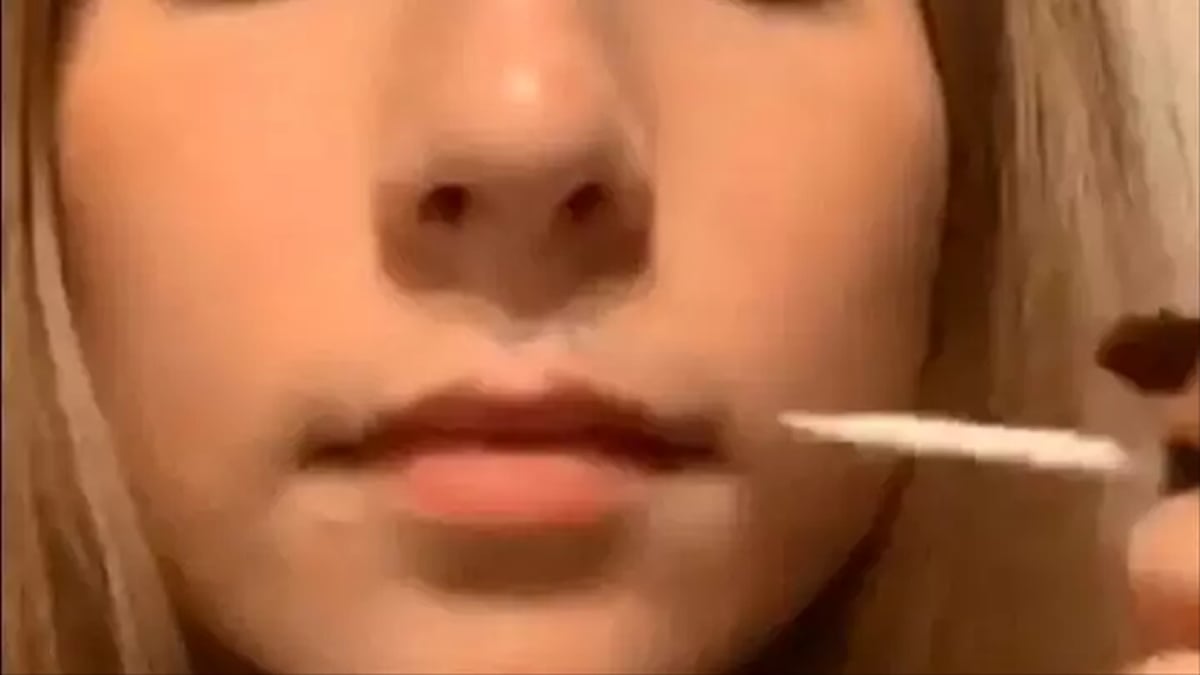 Nueva y peligrosa tendencia de belleza, pegarse el labio a la piel bajo la nariz