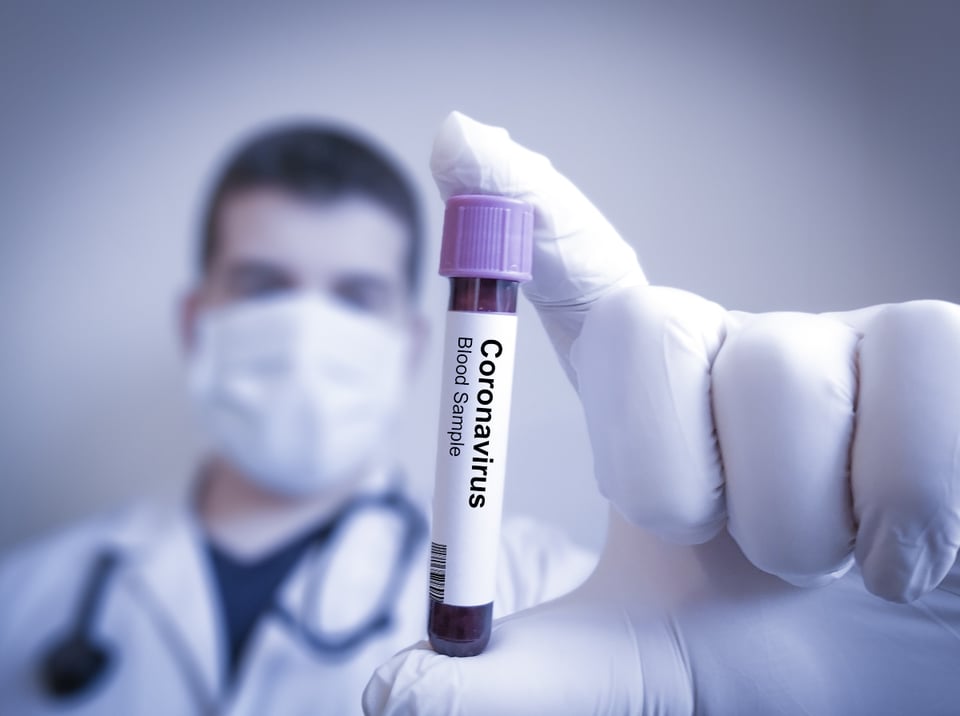 Hijos recaudan ayuda para papá soltero que murió de coronavirus y debía pago de alquiler