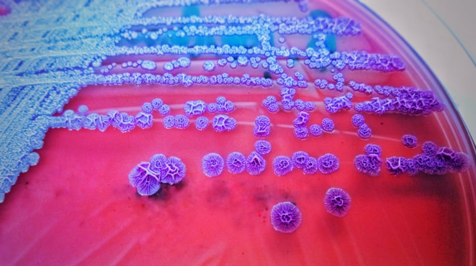 Melioidosis en EEUU: CDC lanzan advertencia tras dos muertes por extraña enfermedad featured image