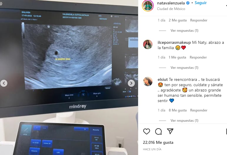 Natalia Valenzuela anuncia: Perdió a su segundo bebé