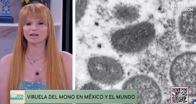 Advierte sobre la viruela del mono