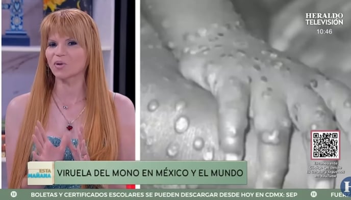 Mhoni dice que lo peor está por venir