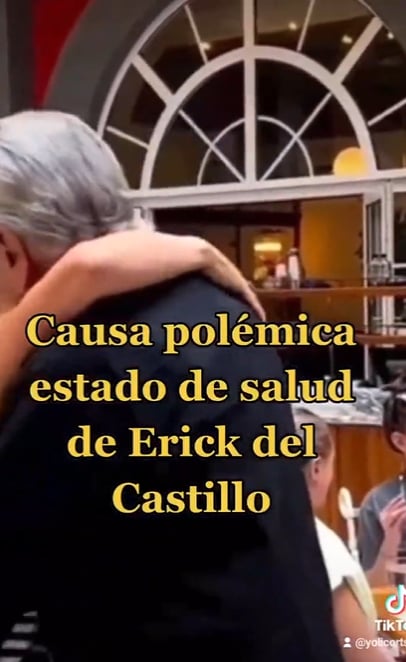 ¿Qué tiene el actor?