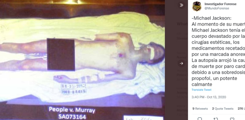 Michael Jackson autopsy: He was bald