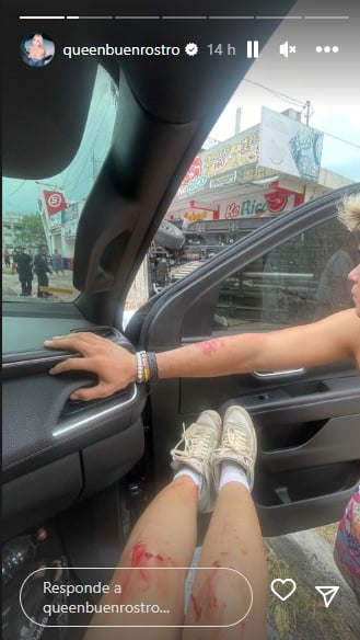 Daniela Buenrostro accident: Appears with injuries