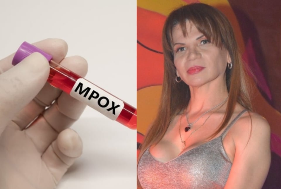 Mhoni Vidente hace severa advertencia sobre la viruela del mono