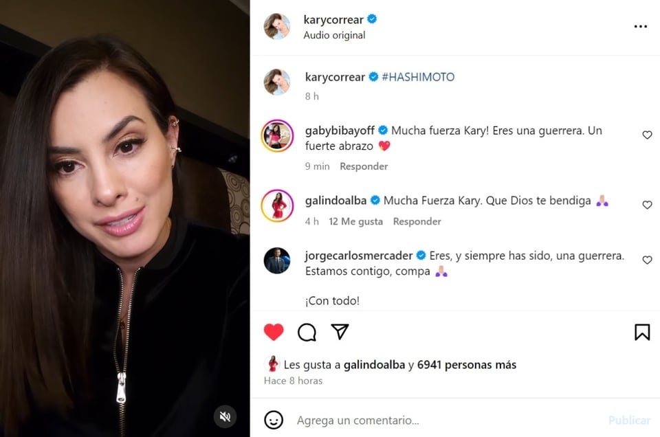 Kary Correa, Hashimoto, enfermedad autoinmune, redes sociales, MundoNOW