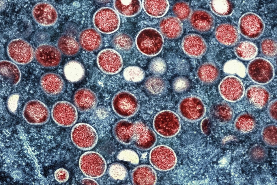 Declaran emergencia global por nuevo virus