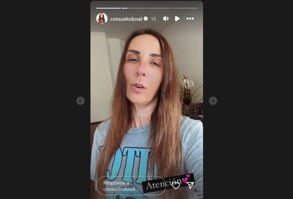 actriz Consuelo Duval, Nacaranda, Federica P. Luche, implante mamario, MundoNOW