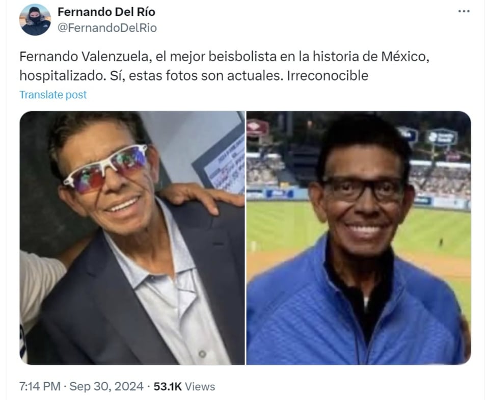 Fernando Valenzuela, salud, transmisiones, radio, MundoNOW