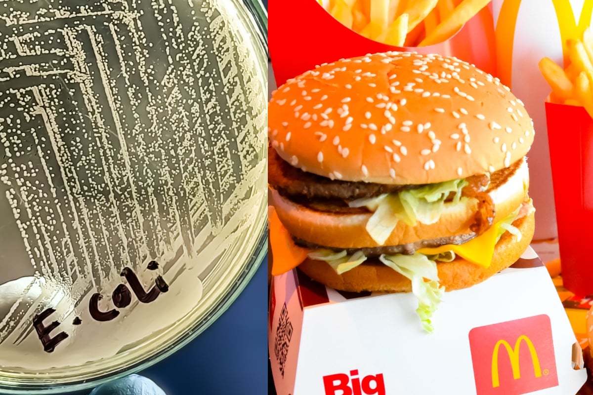 E. Coli outbreak linked to McDonald’s affects 75 people