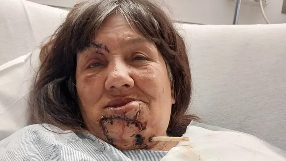 Ataque de perro  en Walmart deja a mujer hispana herida