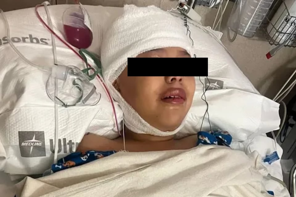 Perro ataca a niña hispana en Idaho y la deja muy mal