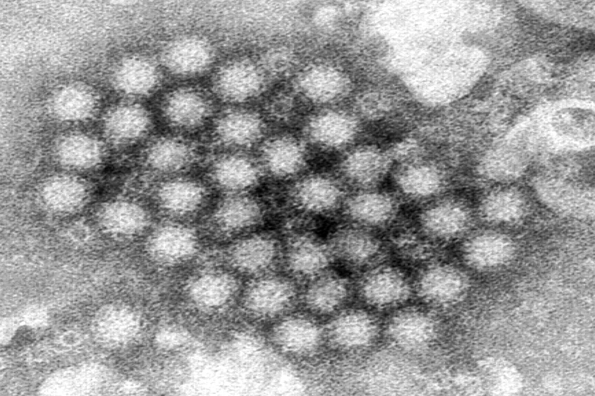 Norovirus EEUU, Estados Unidos, casos, salud, MundoNOW
