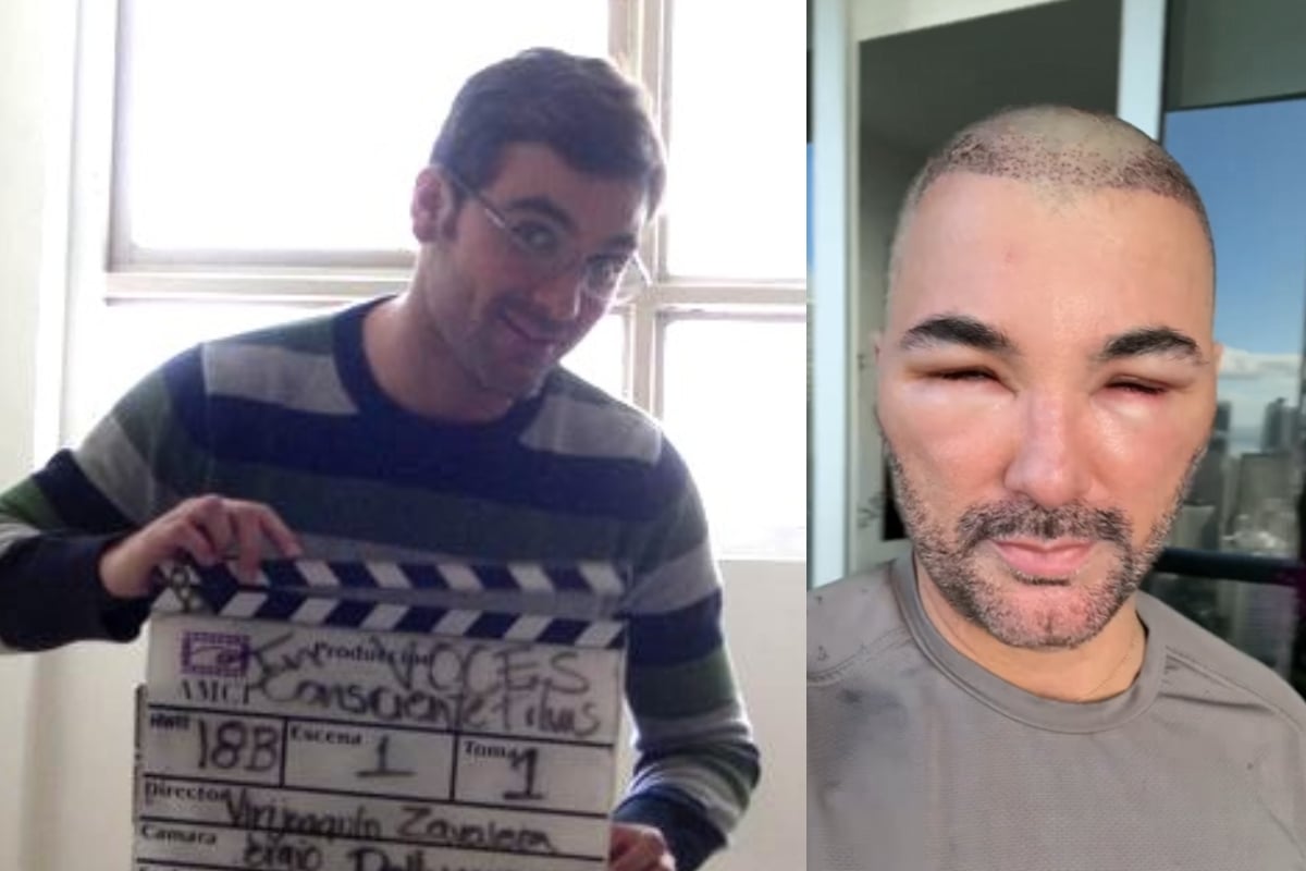 Causa horror el rostro del actor mexicano Mauricio Mejía tras cirugía estética