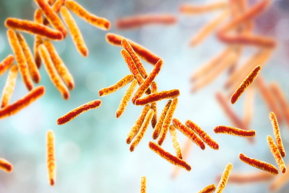 Caso de tuberculosis en Florida, Virus, Enfermedad, Salud, EEUU