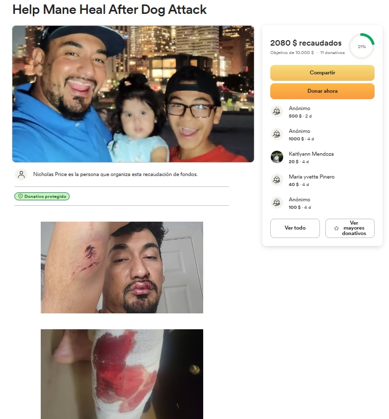 ataque, pitbull, hispano, familia, ayuda