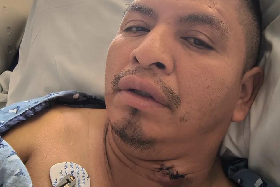 Vendedor ambulante apuñalado en Long Beach busca apoyo para seguir adelante