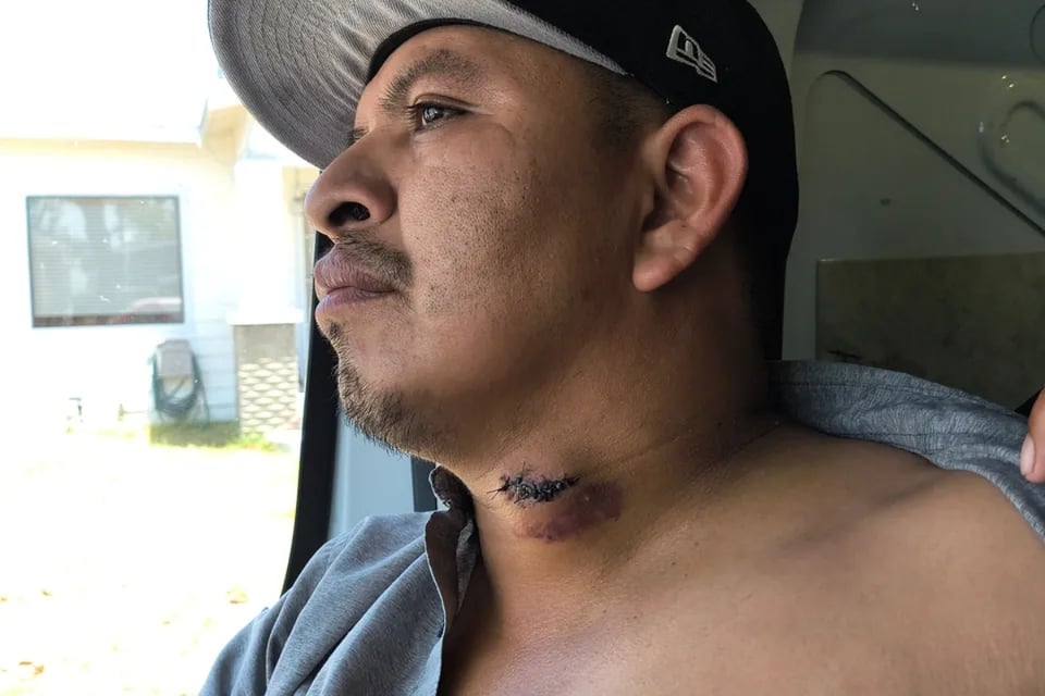 Vendedor ambulante hispano apuñalado en su trabajo en Long Beach