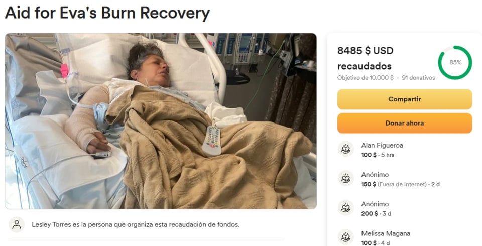 Piden ayuda para hispana que sufrió graves quemaduras