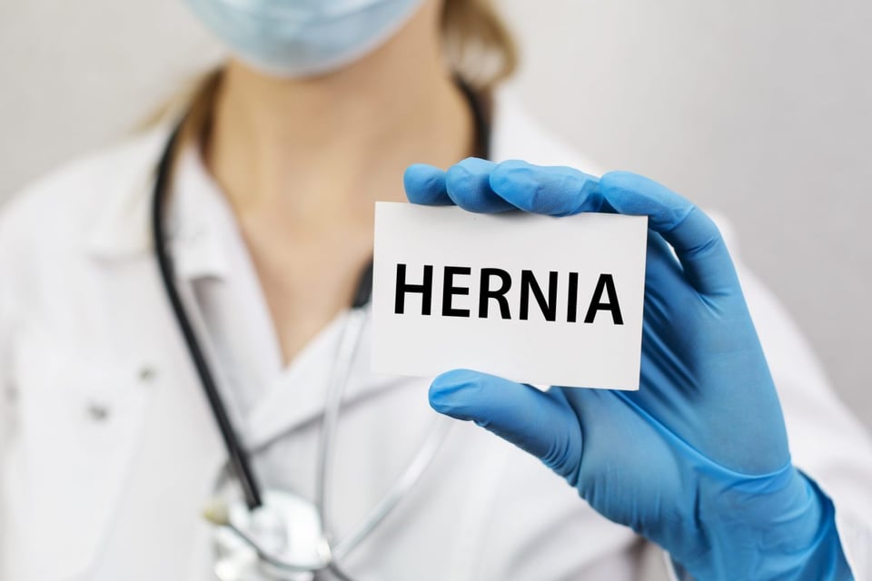 ¿Qué es una Hernia y cómo evitarla? Según la medicina!