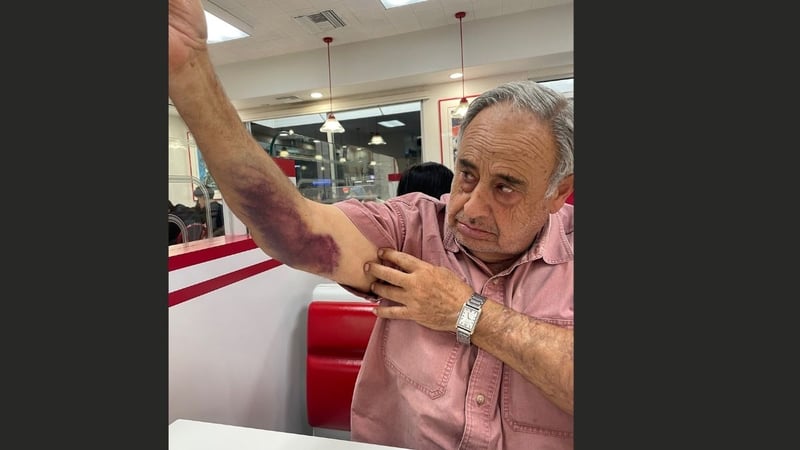 abogados, brazo, victima 