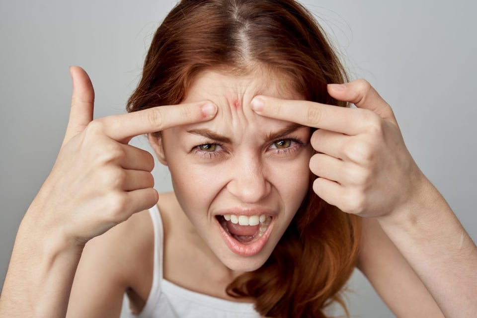 ¿Cómo eliminar un grano rápido y sin dejar marca? Dermatólogo revela el método seguro!